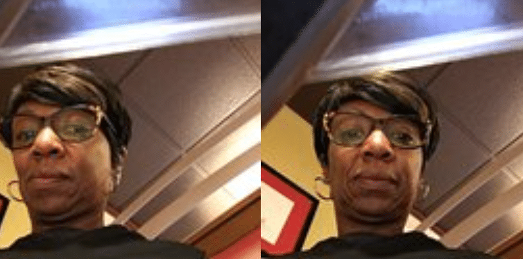 ¿Necesito levantamiento facial?