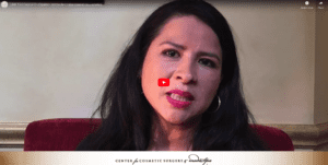 Edith Testimonial En Espanol- centro de cirujia cosmetica y estetico