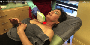 Part 2- IPL at Dr. Dean Kane's Center for Cosmetic Surgery and MediSpa
