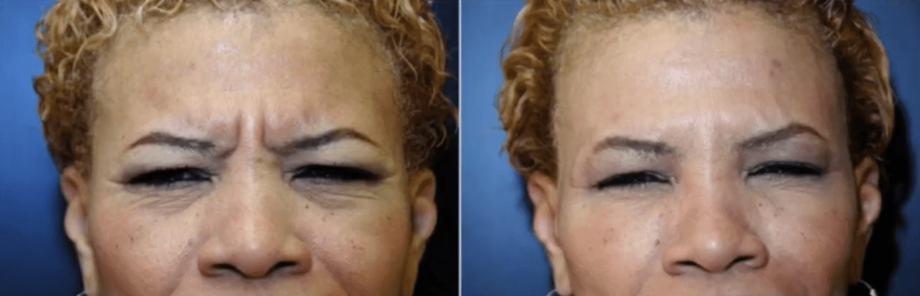 Lauri Kane Discusses Filler for the 11s